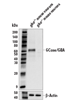 88162_Gcase GBA antibody parkinsons biomarker