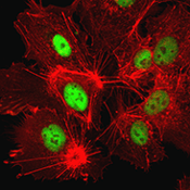 hypoxia antibody sampler kit_thumbnail