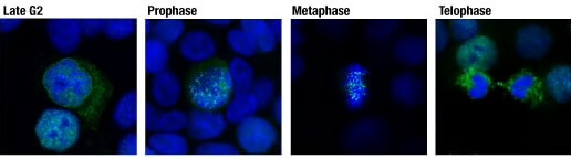 Immunofluorescent analysis of HT-29 cells at various stages of mitosis using CENP-F antibody