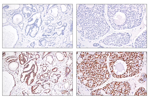 72364_SS18-SSX_fusion protein antibody