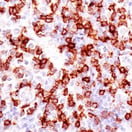 99567 TIGIT IHC antibody_Cancer_B-cell non-hodgkin lymphoma thumbnail