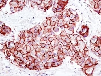 CST4290_HER2 Breast Cancer biomarker Recombinant Antibody