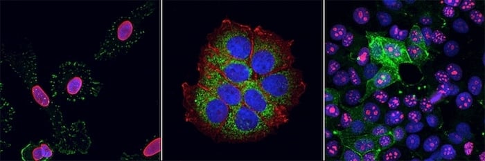 Immunofluorescence staining with two antibodies