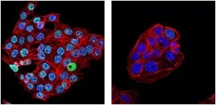 IF analysis of HCT 116 cells, either wild-type (left) or 53BP1 knockdown (right), using 53BP1 (E7N5D) Rabbit Monoclonal Antibody.