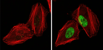 Immunofluorescent (IF) analysis of HeLa cells, untreated (left) or UV-treated (right), using Phospho-Histone yH2A.X antibody to detect DNA damage.