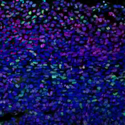 IF analysis of LL/2 syngeneic using p21 Waf1Cip1 antibody.
