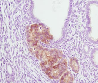 IHC analysis of PTEN mutant mouse endometrium using phospho-Akt (Ser473) antibody.
