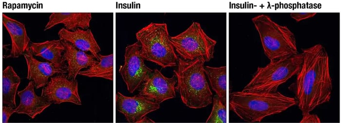 F analysis of HeLa cells, rapamycin-treated (#9904, 10 nM for 2 hours, left), insulin-treated (150 nM for 6 minutes, middle) or insulin- and λ-phosphatase-treated (right), using Phospho-mTOR (Ser2448) antibody.