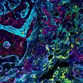 SignalStar Multiplex IHC thumbnail