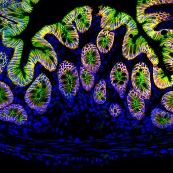 Multiplex imaging of fresh, frozen tissue using a direct immunofluorescence method (fluorophore-conjugated primary antibodies).