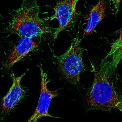 Multiplex imaging of HeLa cells using a direct immunofluorescence method (fluorophore-conjugated primary antibodies).