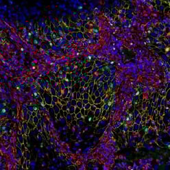 Multiplex imaging of FFPE tissue using an indirect immunofluorescence method and chimeric antibodies (host-based multiplexing using secondary antibodies).