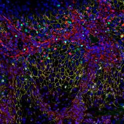 Multiplex imaging of FFPE tissue using an indirect immunofluorescence method and chimeric antibodies (host-based multiplexing using secondary antibodies).