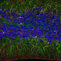 Multiplex imaging of fresh, frozen tissue using an indirect immunofluorescence method and chimeric antibodies (host-based multiplexing using secondary antibodies).