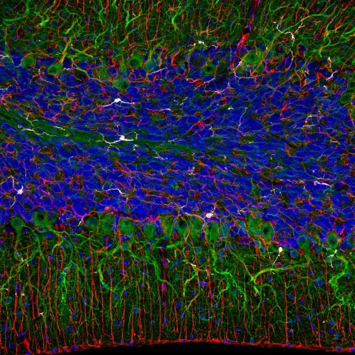 Multiplex imaging of fresh, frozen tissue using an indirect immunofluorescence method and chimeric antibodies (host-based multiplexing using secondary antibodies).