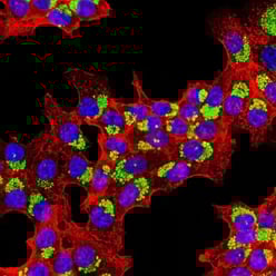Multiplex imaging of HeLa cells using an indirect immunofluorescence method (host-based multiplexing using secondary antibodies).