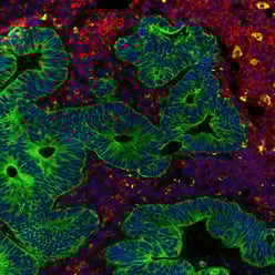 Multiplex imaging of FFPE tissue using a direct immunofluorescence method (fluorophore-conjugated primary antibodies).