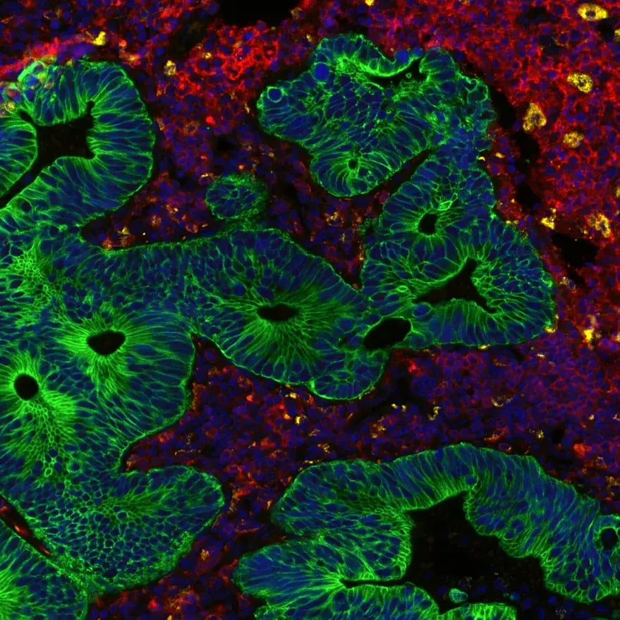 Multiplex imaging of FFPE tissue using a direct immunofluorescence method (fluorophore-conjugated primary antibodies).