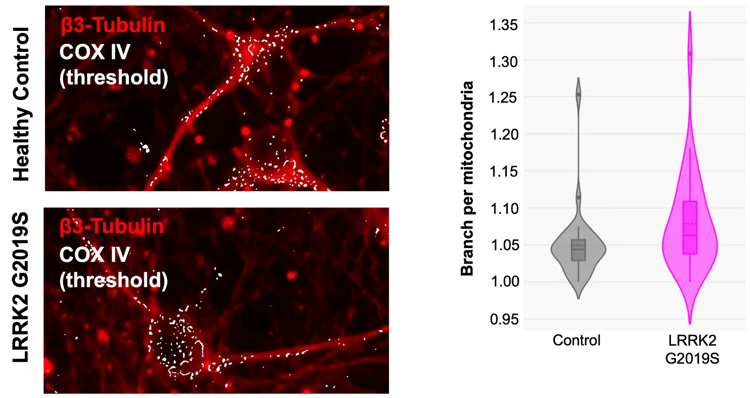 Immunofluorescence images of mitochondrial morphology in iPSC-derived iCell DopaNeurons from healthy control and LRRK2 G2019S conditions stained for COX IV, with thresholded visualization of mitochondrial networks and quantification of branches per mitochondrion across conditions.