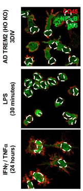 Immunofluorescence images of NF-κB p65 localization in iCell microglia and TREM2 homozygous knockout microglia following LPS or cytokine treatment.