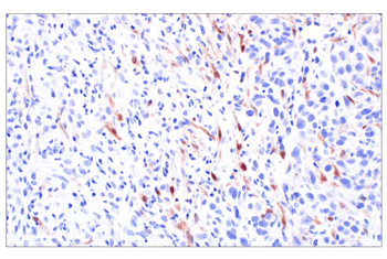 IHC&nbsp;analysis of paraffin-embedded 4T1 syngeneic tumor using p16 INK4A (F2T7H) Rabbit Monoclonal Antibody #23200.