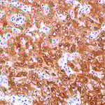 DAT-LEFT-88667_fig08_IHC-P_1989_20250630142005 copy