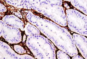 DAT-19245_fig01_IHC-Bond_1444_20240123142628_cropped