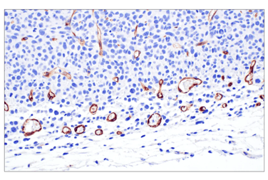 IHC analysis of paraffin-embedded CT26.WT syngeneic tumor using VE-Cadherin (F4K3Y) Rabbit Monoclonal Antibody #60787.