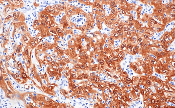 DAT-LEFT-88667_fig08_IHC-P_1989_20250630142005