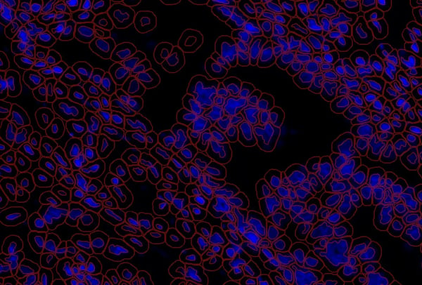 26-OLI-05300_Cell segmentation QuPath