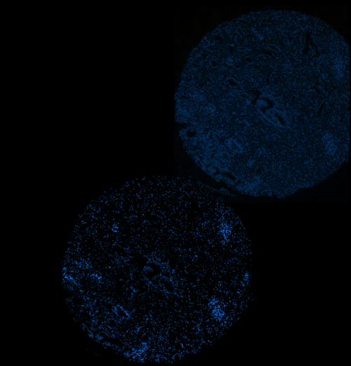 26-OLI-05300_QuPath Image Alignment