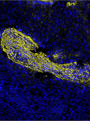 41483_72026 SignalStar Secondary Antibody Kit
