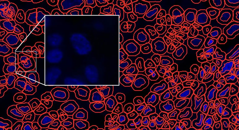26-OLI-93750 Blog Mid-Plex in Spatial Biology Fig 1