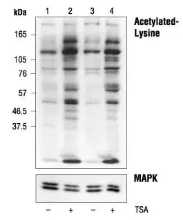 Western blot analysis of extracts from COS cells, untreated or TSA-treated, grown in 10% FBS or serum starved for 18 hours, using Acetylated-Lysine Antibody #9441 or p44/42 MAP Kinase Antibody #9102.