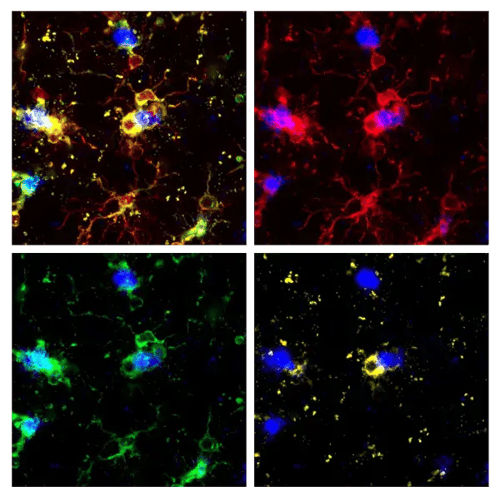 IF analysis of Amyloid Mouse Model using Iba1, GPNMB, and HS1 antibody (Image from Colonna Lab)