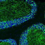 GAD2 antibody_neuronmarker sampler kit thumbnail