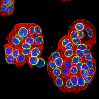 LaminB1 antibody Senescence marker
