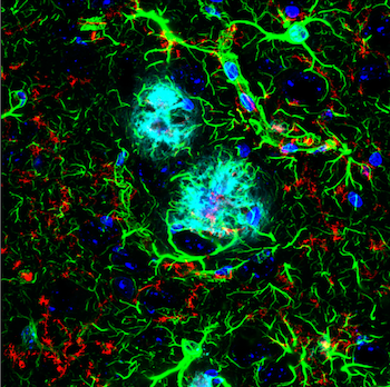 Amyloid mouse model brain analyzed usingTMEM119 and β-Amyloid