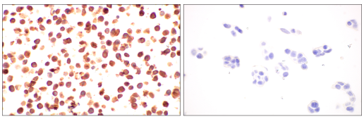 p16 Ink4A antibody validation for IHC