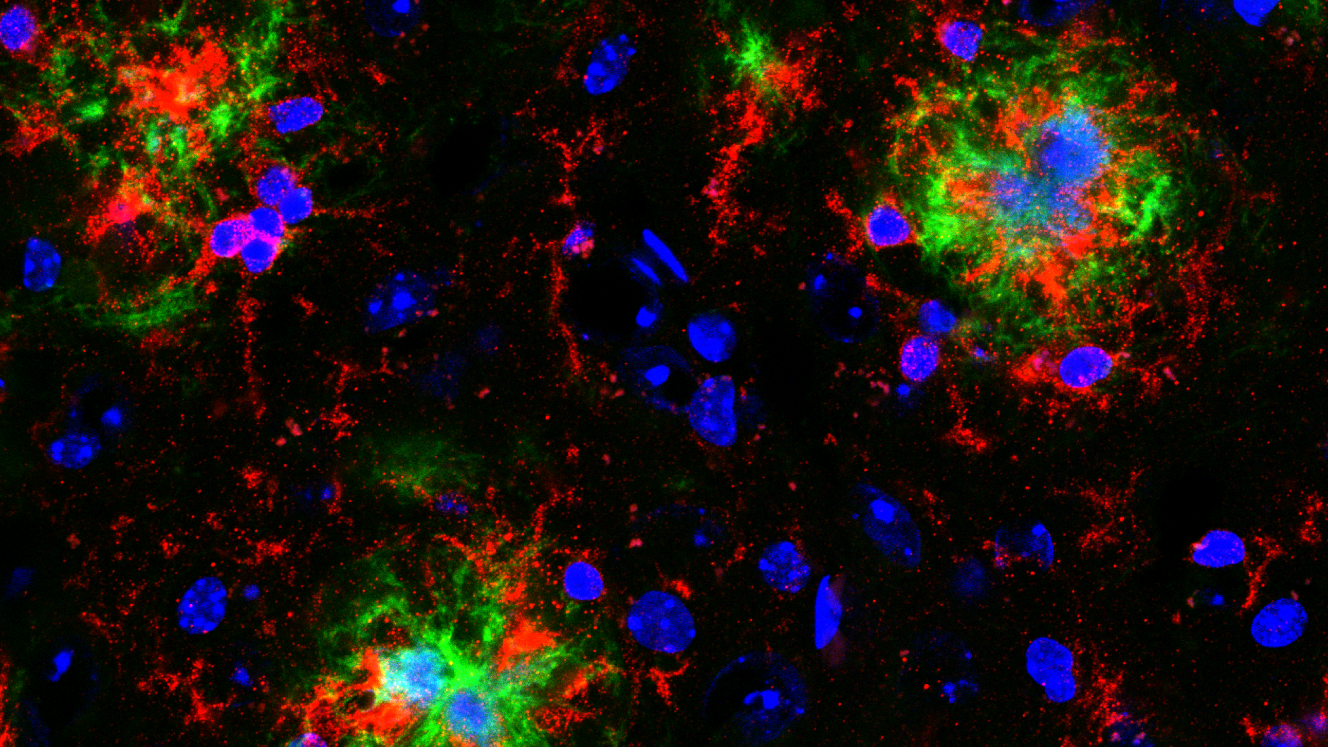 Astrocyte Activation Markers for CNS Injury & Neurodegenerative Disease Research