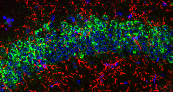 Your Antibody Toolbox for Neurodegenerative Disease Biomarker Research with Biofluid Samples