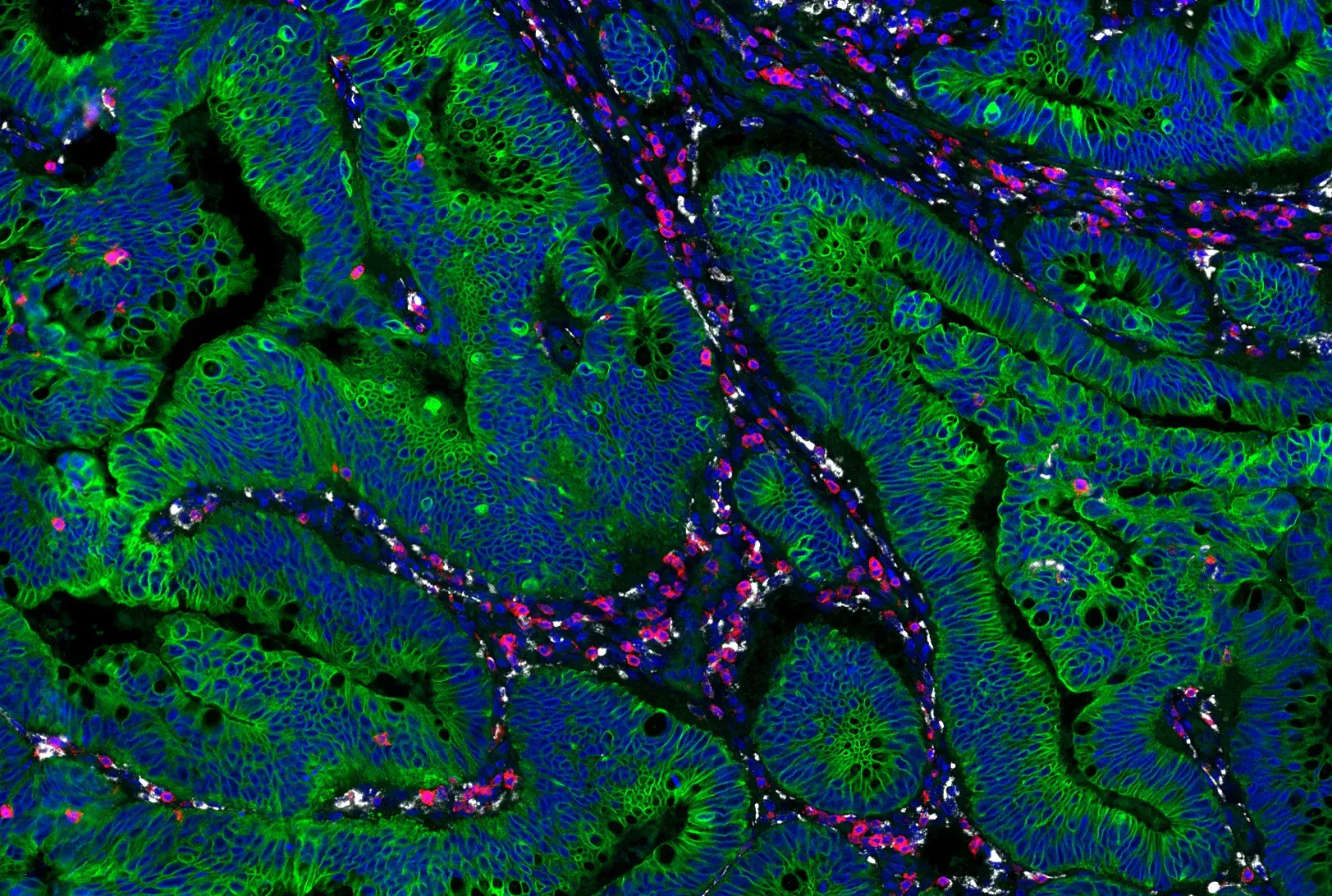Accurately Identify Tumor Cells in the TME: Discover Pan-Keratin Rabbit MultiMab® Antibodies