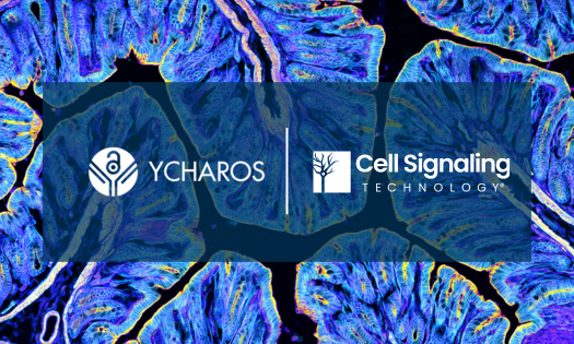 Setting the Standard: CST's Commitment to Antibody Validation Through YCharOS