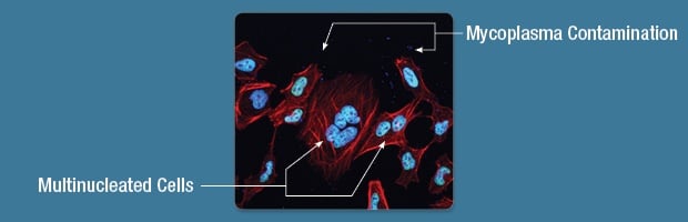 IF Mycoplasma Contamination