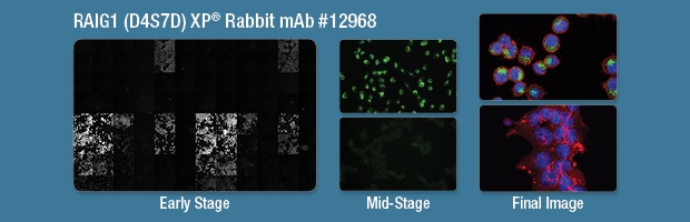 RAIG1 (D4S7D) XP® Rabbit mAb #12968