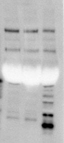 WB: Overloading and saturation Cleaved Casp1(Asp296)