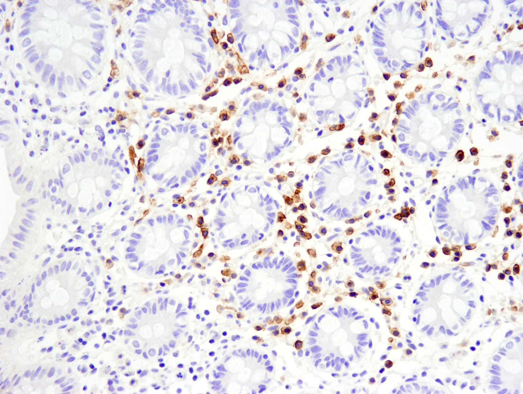Immunology: What are lymphoid cells and how are they identified?