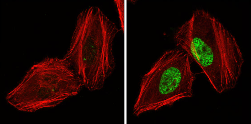 Phospho histone H2a ser139