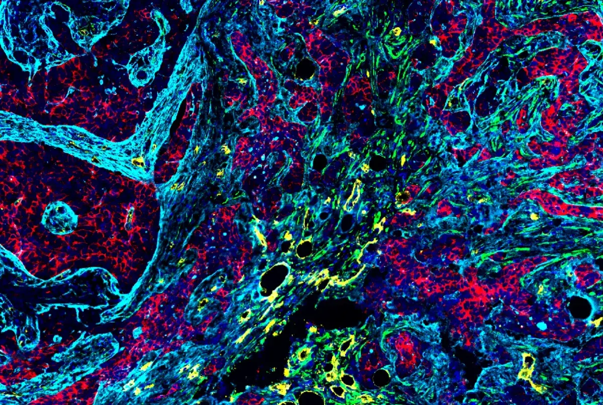 Antibody Compatibility Trifecta: Choosing a Multiplexing Strategy for Reliable Spatial Biology Insights