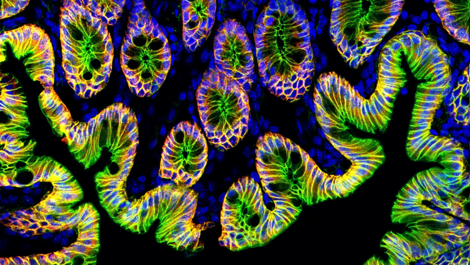 Fluorescent Staining with Multiple Antibodies: Direct vs Indirect Methods for Multiplex Immunofluorescence
